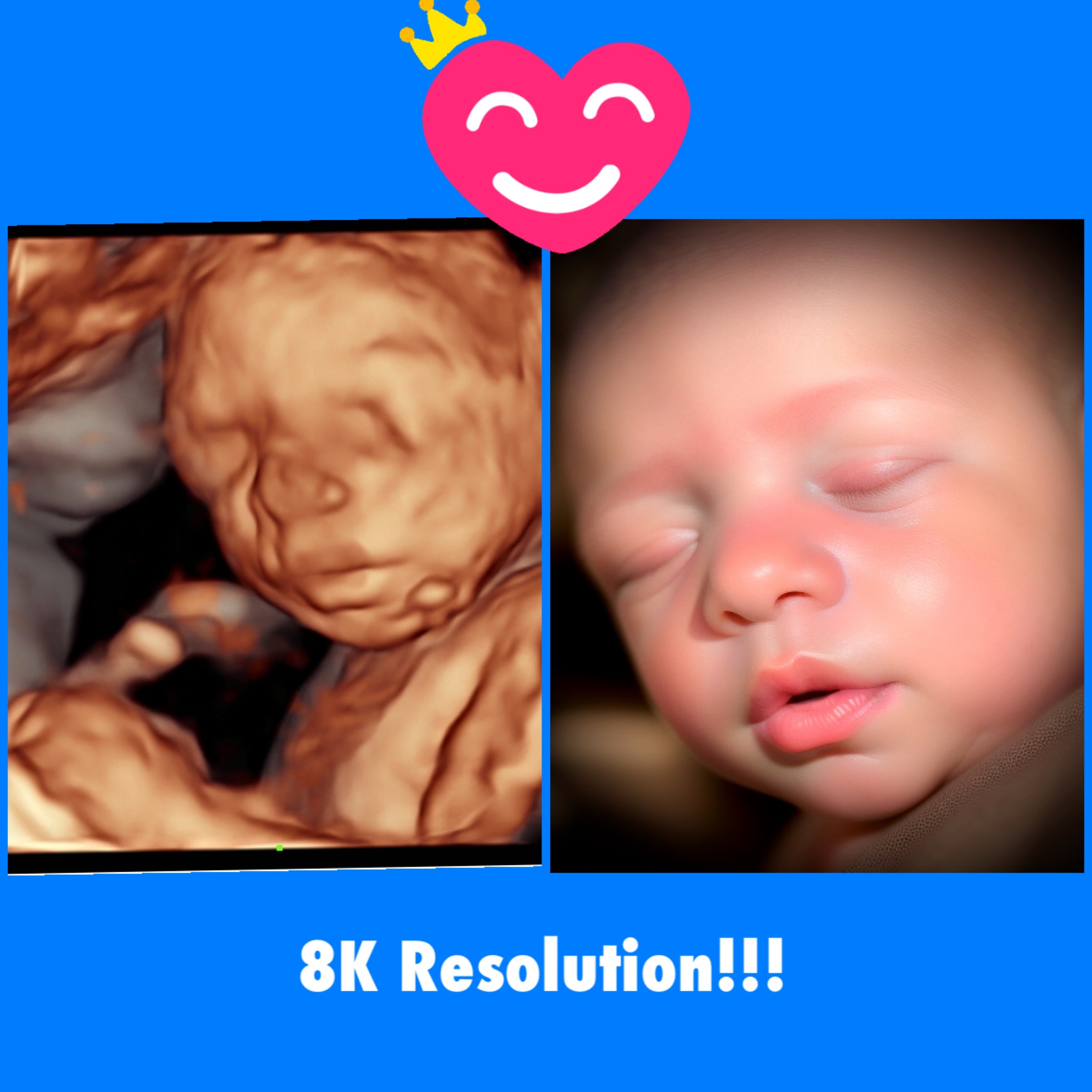 Miracle Ultrasound/Sonogram/Pregnancy Brag Photo Book (Blue Ribbon)